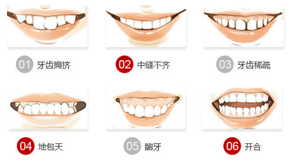 牙齿矫正的利与弊