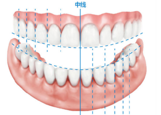 牙齿不齐的矫正过程是什么样