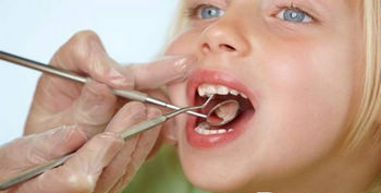 儿童龋齿影响口腔健康